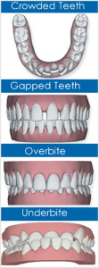 problems caused by crooked teeth