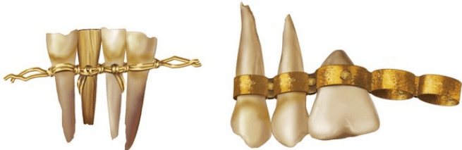 Ancient Egyptians & Greeks Used Orthodontics Too