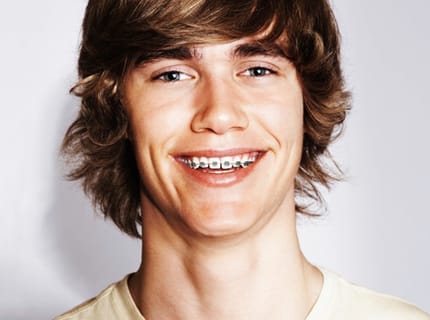 teenager with orthodontic dental braces