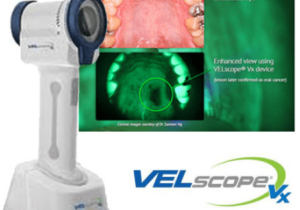 velscope enhanced cancer screening tool and images